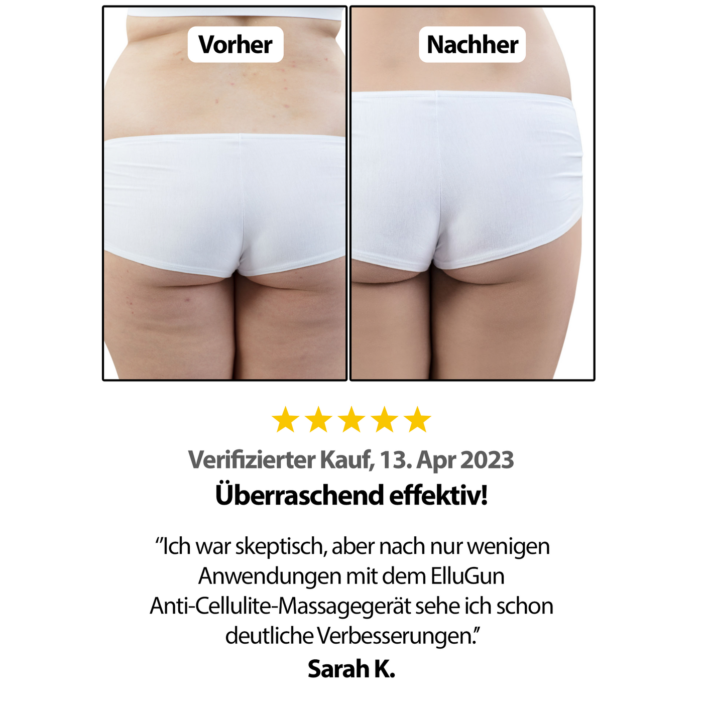 Ellugun - Anti Cellulite - Massagegerät - FIVEinONE 28W