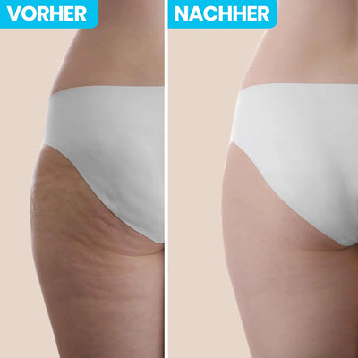 ANTI CELLULITE INFRAROT MASSAGEGERÄT + 5 Aufsätze